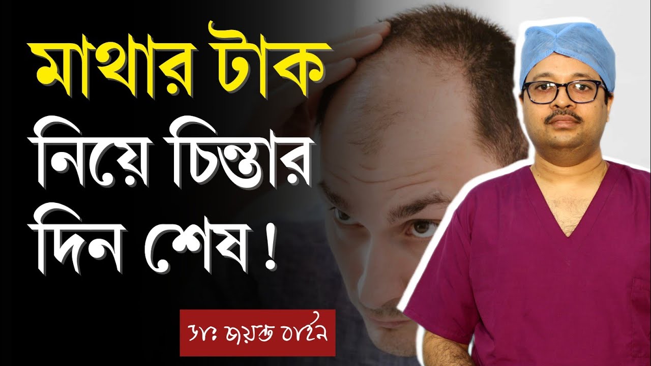 মাথার টাক ঢেকে যাবে ঘন চুলে! হেয়ার ট্রান্সপ্লান্ট এর খরচ কত? | Hair Transplant - Dr Jayanta Bain