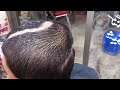 NEW VIDEOS 2026 💥 DEEP SKIN CLEANING (AMAZING RESULTS)