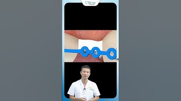 Mất Răng Có Niềng Được Không ?| Bác Sĩ Yên