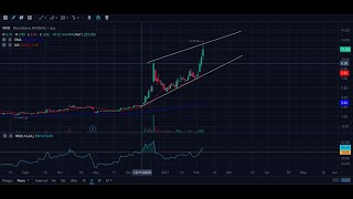 MVIS Technical Analysis, Fundamental Breakdown, Microvision