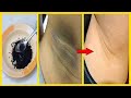 How To Whiten Dark Underarms Instantly Permanently | 100% Works At Home