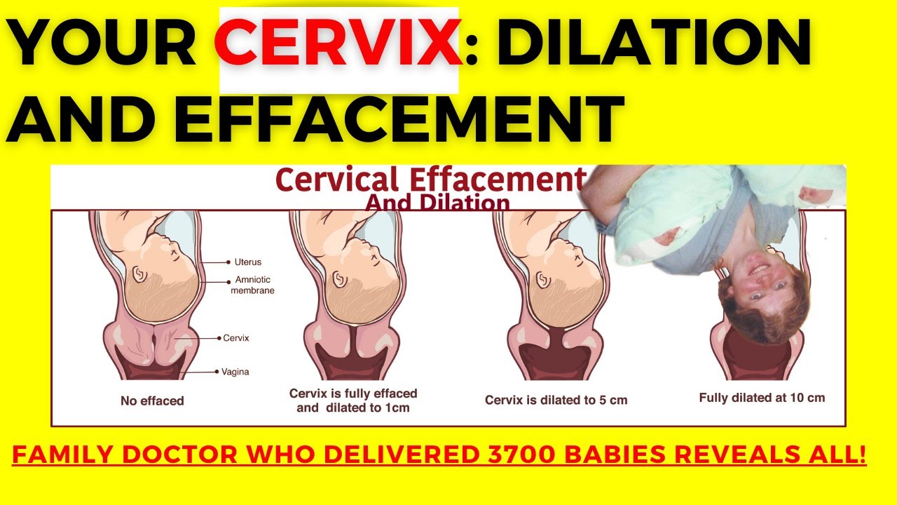 Effacement Testing Cervical dilation and cervical effacement: everything you need to know ...