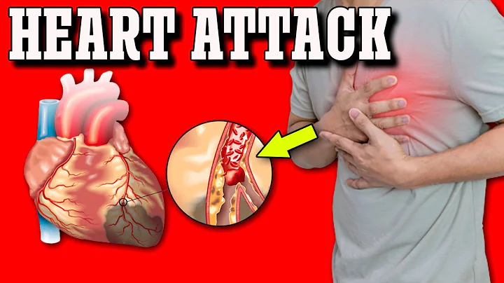 7 Heart Attack Symptoms You Should Never Ignore!
