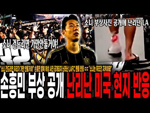 "<strong>소니</strong> 건드리면 우리가 가만 안둘거야!" 손흥민 발복 부상 사진 공개되자 난리난 LAFC 팬들 반응 ㄷㄷ "소니는 무조건 지켜야돼!"