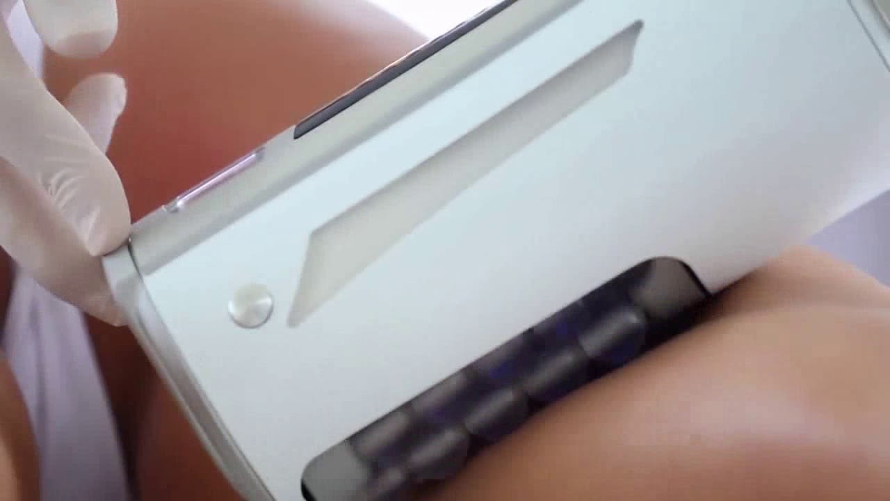 Эндосфера терапия (Endospheres Therapy) в клинике эстетической медицины "Ника Спринг"