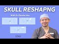 Skull reshaping with dr charles hsu  line plastic surgery center los angeles    