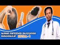 Rifeensa Keenya Maaltu Huba Kutaa 1 Causes Of Hair Loss Rifeensa Keenya Maaltu Huba Kutaa 1 Causes Of Hair Loss