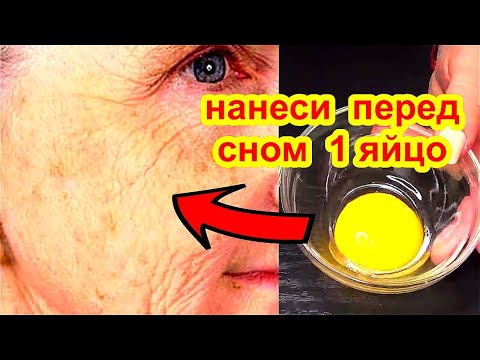 НАНЕСИТЕ 1 Раз Перед Сном! Подтянется Даже Дряблая Кожа в 70 Лет Маска для Лица от Морщин