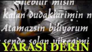 Yarasi Deri̇n Durak Yi̇ği̇t Vi̇deosu