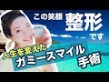 鏡を見て泣いたことありますか?【笑顔の美容整形】ガミースマイルで人生変わった!