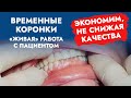 Временные (провизорные) коронки CharmTemp Crown. «Живая» работа с пациентом!