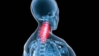 Silat Suffian Bela Diri - Neck Breaker Throw