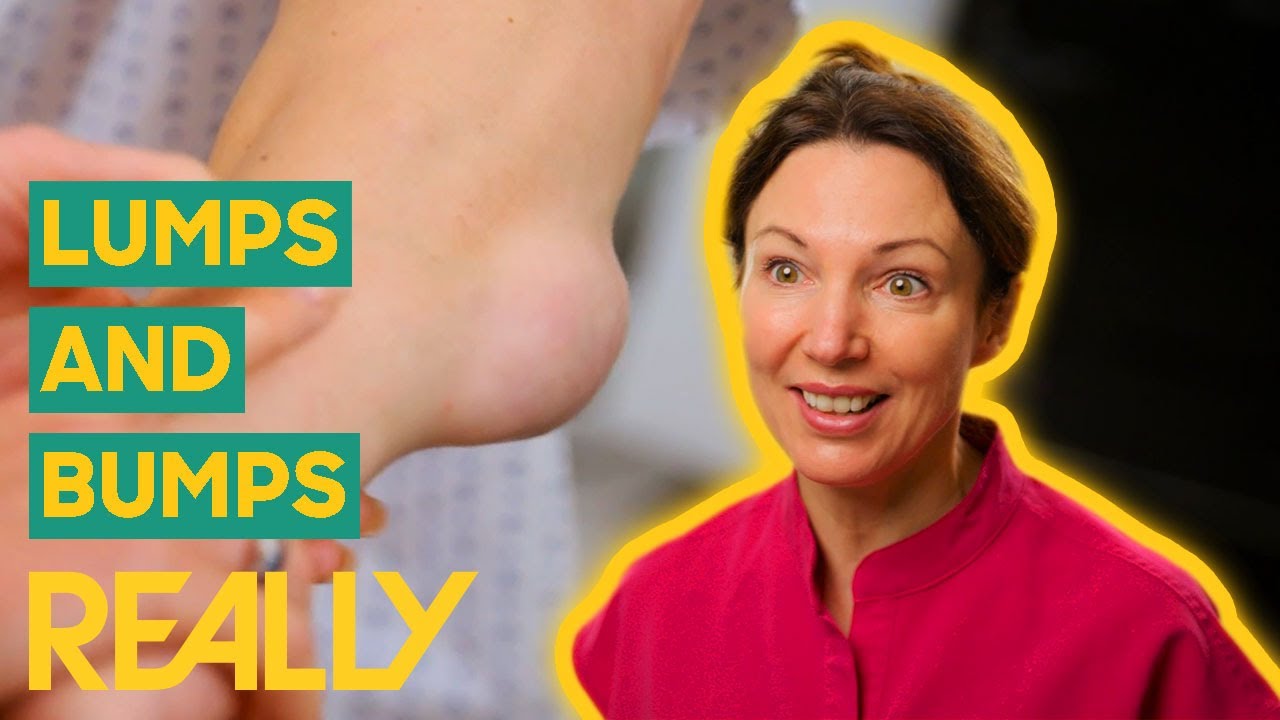 Dr Emma Treats Man With Lumps And Bumps On His Arm And Legs The Bad dr-emma-treats-man-with-lumps-and-bumps-on-his-arm-and-legs-the-bad
