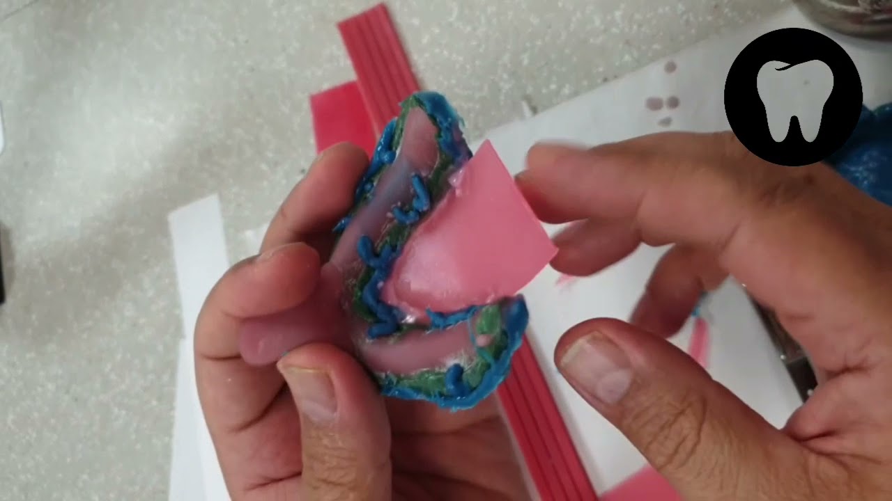 بید و باکسینگ | جلسه چهارم مبانی پروتز کامل