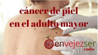 Hematomas la en de piel de ancianos tratamiento