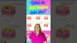 What Do Skin Lesions Look Like?