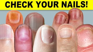 9 Things Your Nails Can Tell You About Your Health