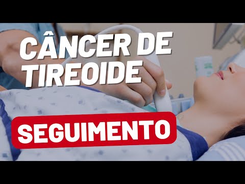 Seguimento do Câncer