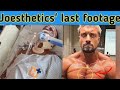 Joesthetics cause of death | German Bodybuilder Jo Lindner has died at 30 | Jo Lindner death reason😭