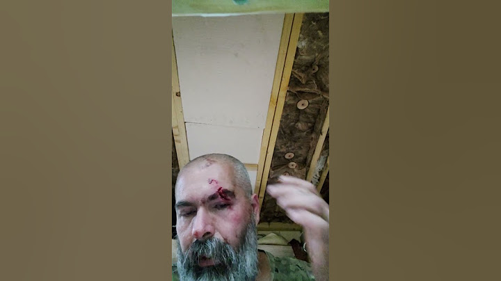 Accident de somnambulisme dans la cabane dans les arbres chute dans un bac de pignes de pin 2021
