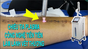 Chiếu Tia Plasma Công nghệ làm lành vết thương "thần tốc