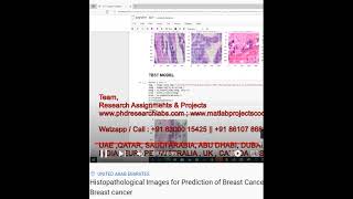 Histopathological Images for Prediction of Breast Cancer Using python code - Breast cancer