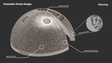 3D Image-Based Workflow for Orthopedics | Image Processing with Synopsys Simpleware