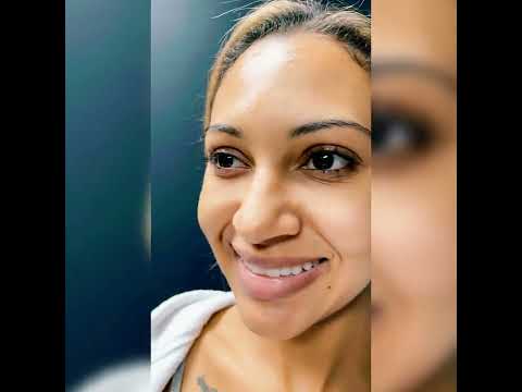 Video thumbnail: 5D Nose Rhinoplasty in Chicago — Dr. Anil Shah
