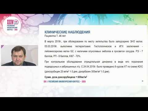 Осложнения при лечении сарком мягких тканей и костей.  Кардиотоксичность. Взгляд химиотерапевта