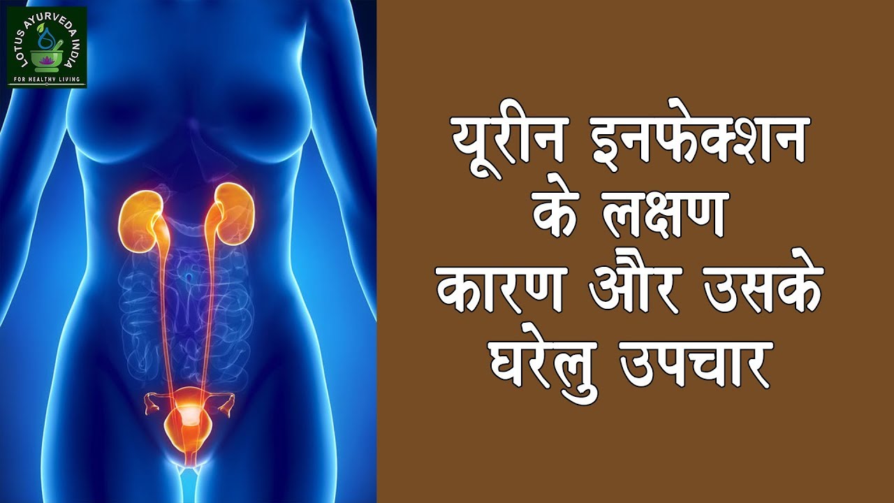यूरीन इन्फेक्शन के लक्षण, कारण और उसके घरेलू उपचार || Urine Infection || Lotus Ayurveda India
