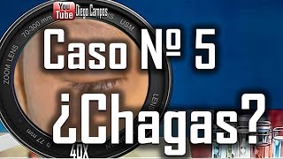 Caso clinico Nº 5.¿ Enfermedad de chagas?