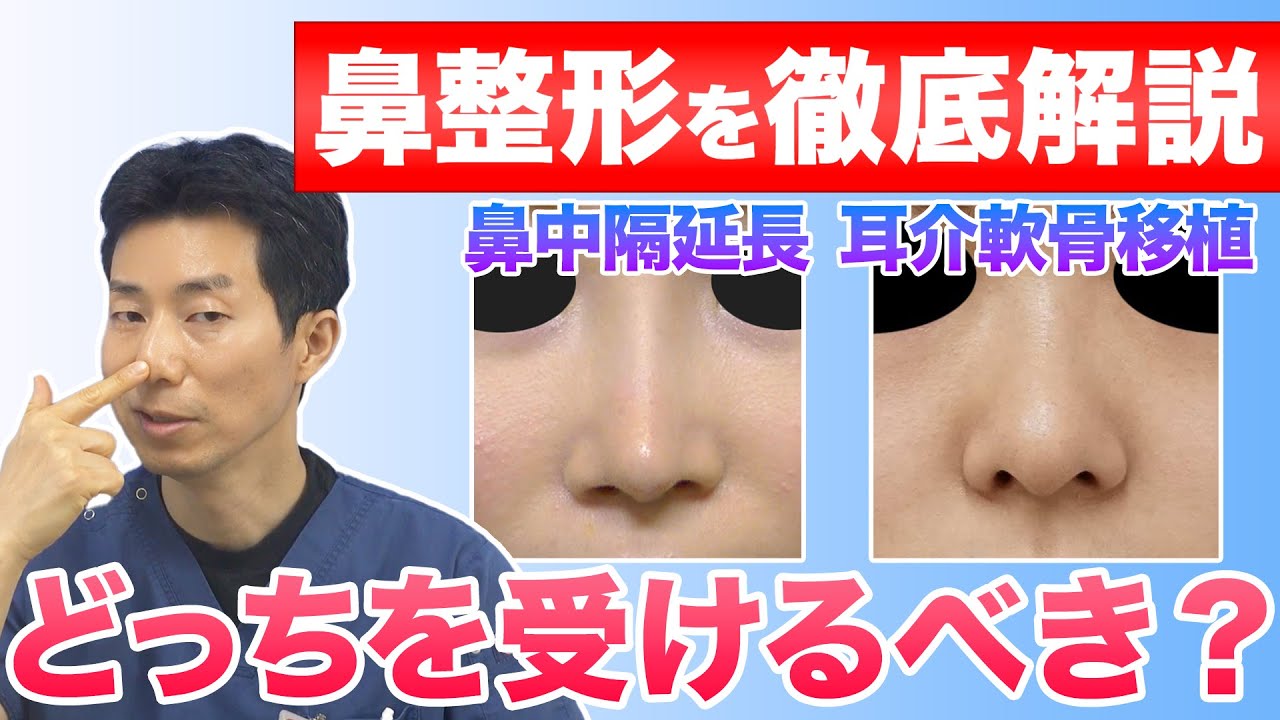 【鼻整形】鼻先は鼻中隔延長と鼻尖形成のどちらを受けるべき? - YouTube