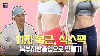 [복부 지방흡입] 식스팩, 11자 복부지방흡입