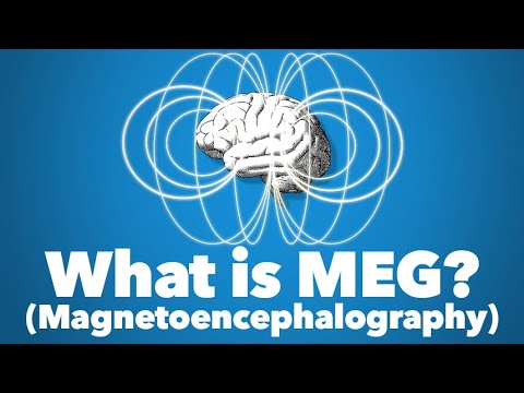 Magnetoencephalography (MEG) - Life Changing Technology for Epilepsy and Neurosurgery Patients