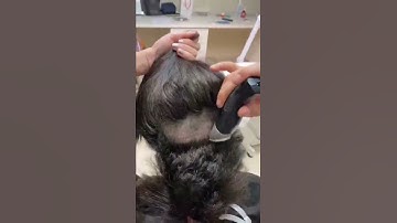 زراعة الشعر للنساء اقلام تشوي || euro pro hair clinic