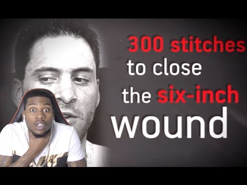 8 WORST SPORTS INJURIES CAUGHT LIVE ON TV REACTION!