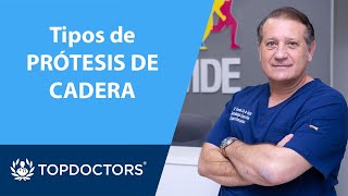 🩺 Descubre los tipos de PRÓTESIS de CADERA y cuándo se usan ▶️ Dr. de la Varga (2/3) | Top Doctors