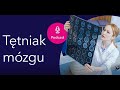 "Gdy zachoruje mózg" Tętniaki mózgu