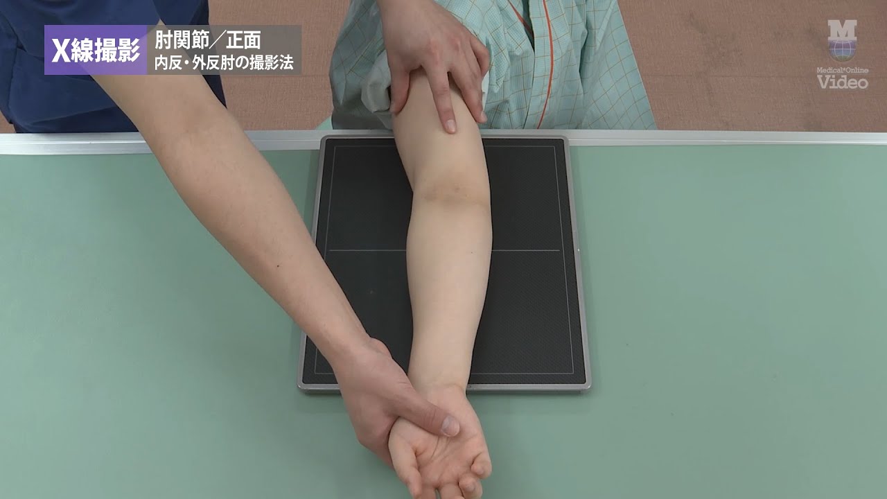 X線撮影 肘関節 内反・外反肘の撮影法 ｜ Medical*Online Video