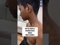 Vitiligo Coverup Treatment In India