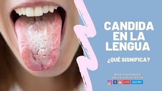 ¿Cándida en la lengua? Descubre lo que significa.👅🔎