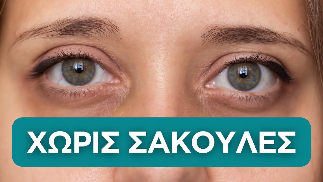 Πώς να Μειώσεις Μαύρους Κύκλους & Σακούλες στα Μάτια σε 5 Λεπτά! | Άντζυ Αλβανούδη, Φαρμακοποιός