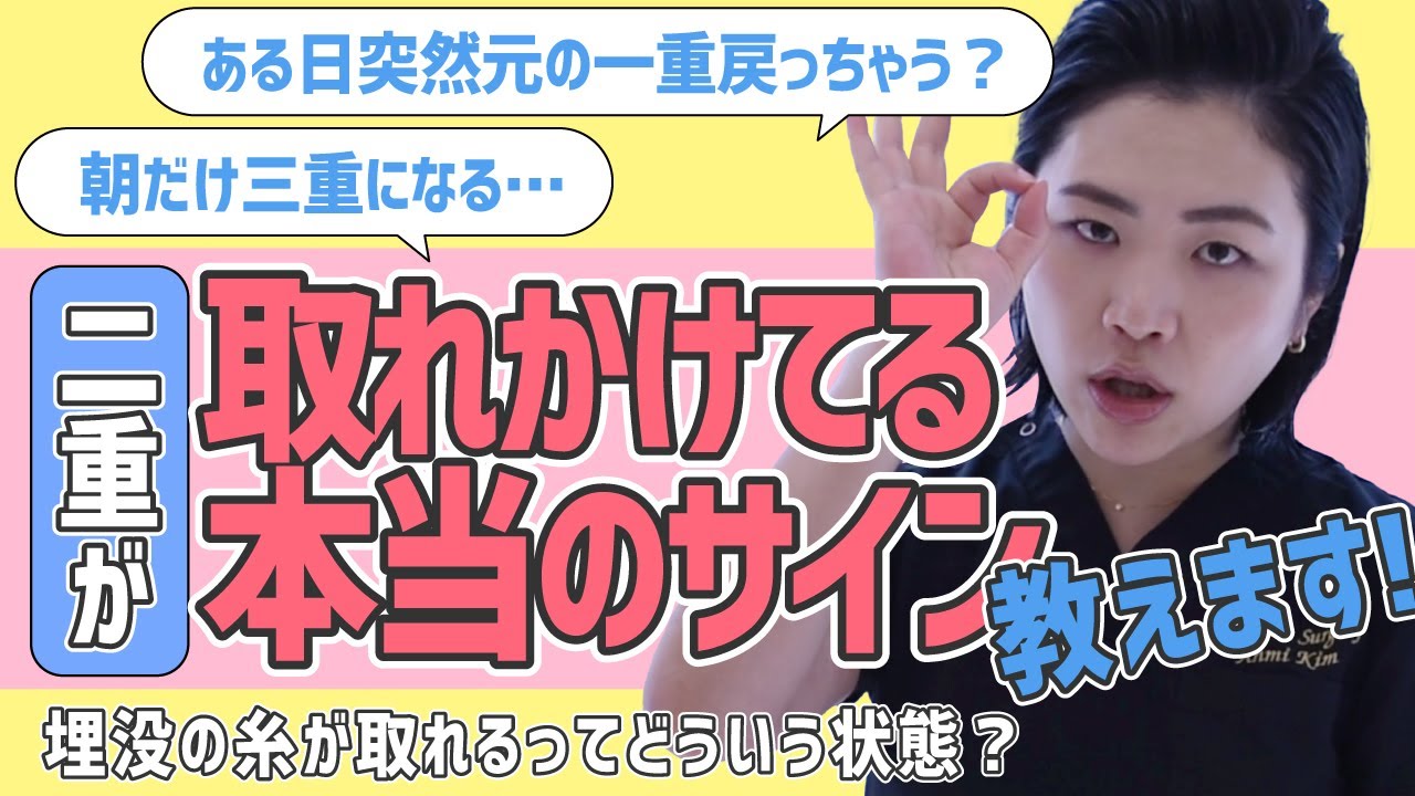 埋没法 二重整形 が取れかけてるサイン 二重が取れたら 埋没の糸 はどうなるの 朝だけ三重になるのは二重が取れるサイン Youtube