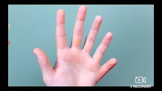 Reacting To Jesse And Mike Six Fingers On Hand