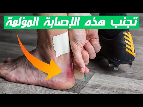 كيف احمي نفسي من اصابات الملاعب بسهولة