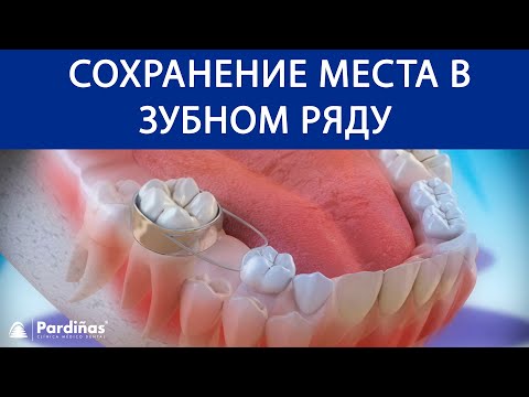 Молочные зубы и сохранение места в зубном ряду ©