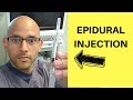 Epidural Injection for Back Pain & Sciatica (Herniated Disc)