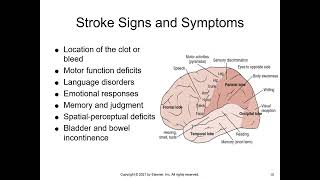 NUR150 Chapter 23 Care of Patients With Brain Disorders
