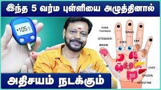 Acupressure Points | acupressure points diabetes | Mayan senthil | Cosmo Health