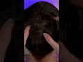 INTENSE ASMR Scalp Massage & Nail Scratching 🔥✨ #asmrshorts